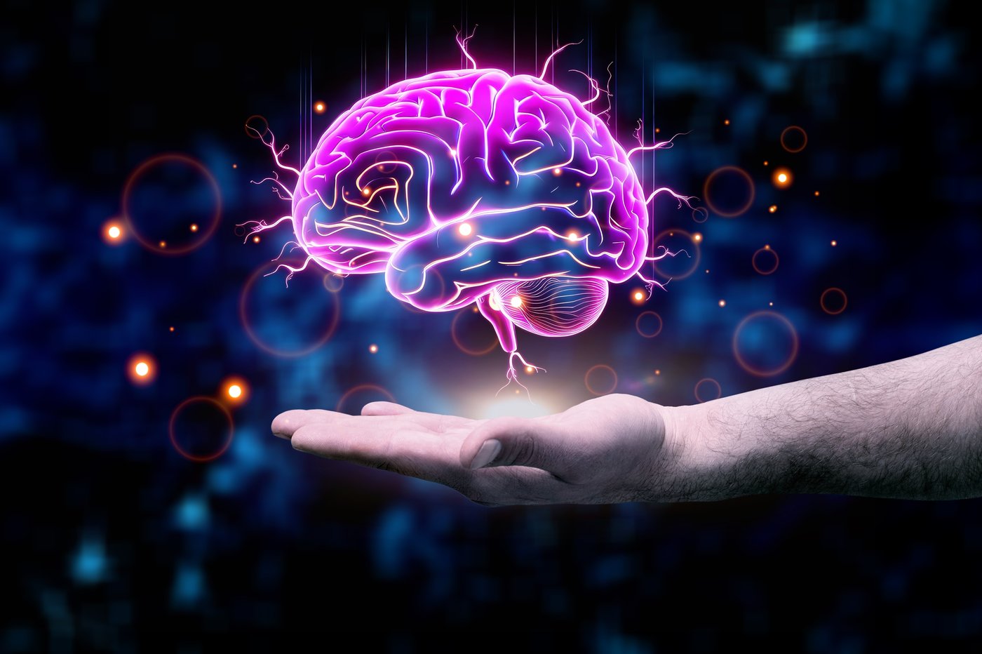 הדמייה של מוח 