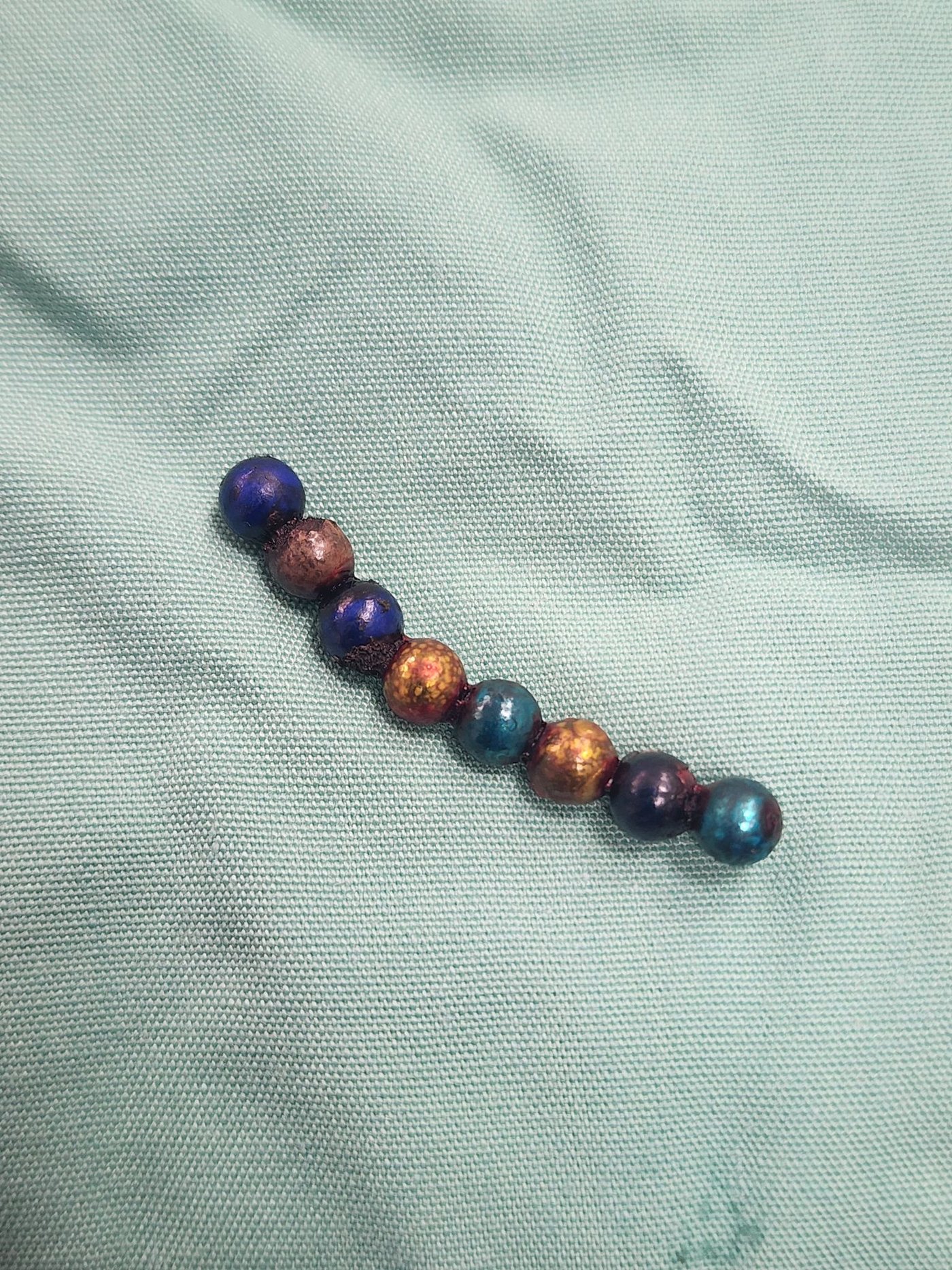 המגנטים שבלע הילד