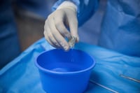 צנתור לב. אילוסטרציה