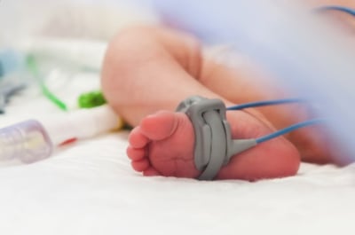 אילוסטרציה