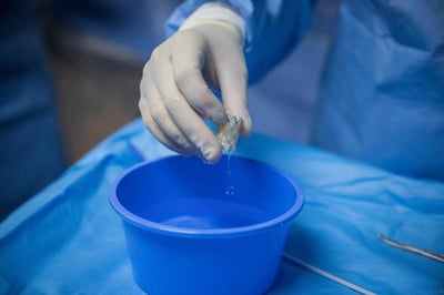 צנתור לב. אילוסטרציה