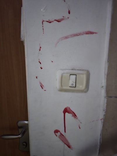 דם מהתקרית הקשה