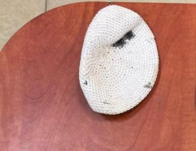 הכיפה שנמצאה