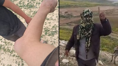 מימין התוקף, משמאל החבלה שנגרמה