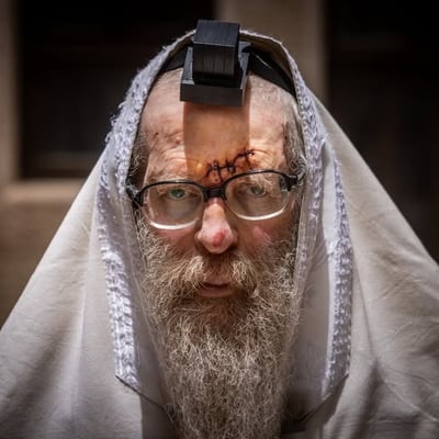 היהודי המבוגר שנפצע במירון תשפ"ד 