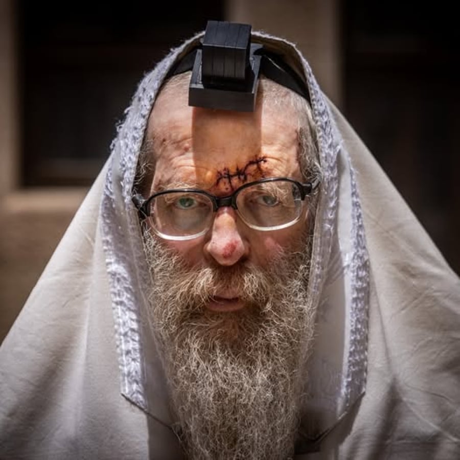 היהודי המבוגר שנפצע במירון תשפ"ד