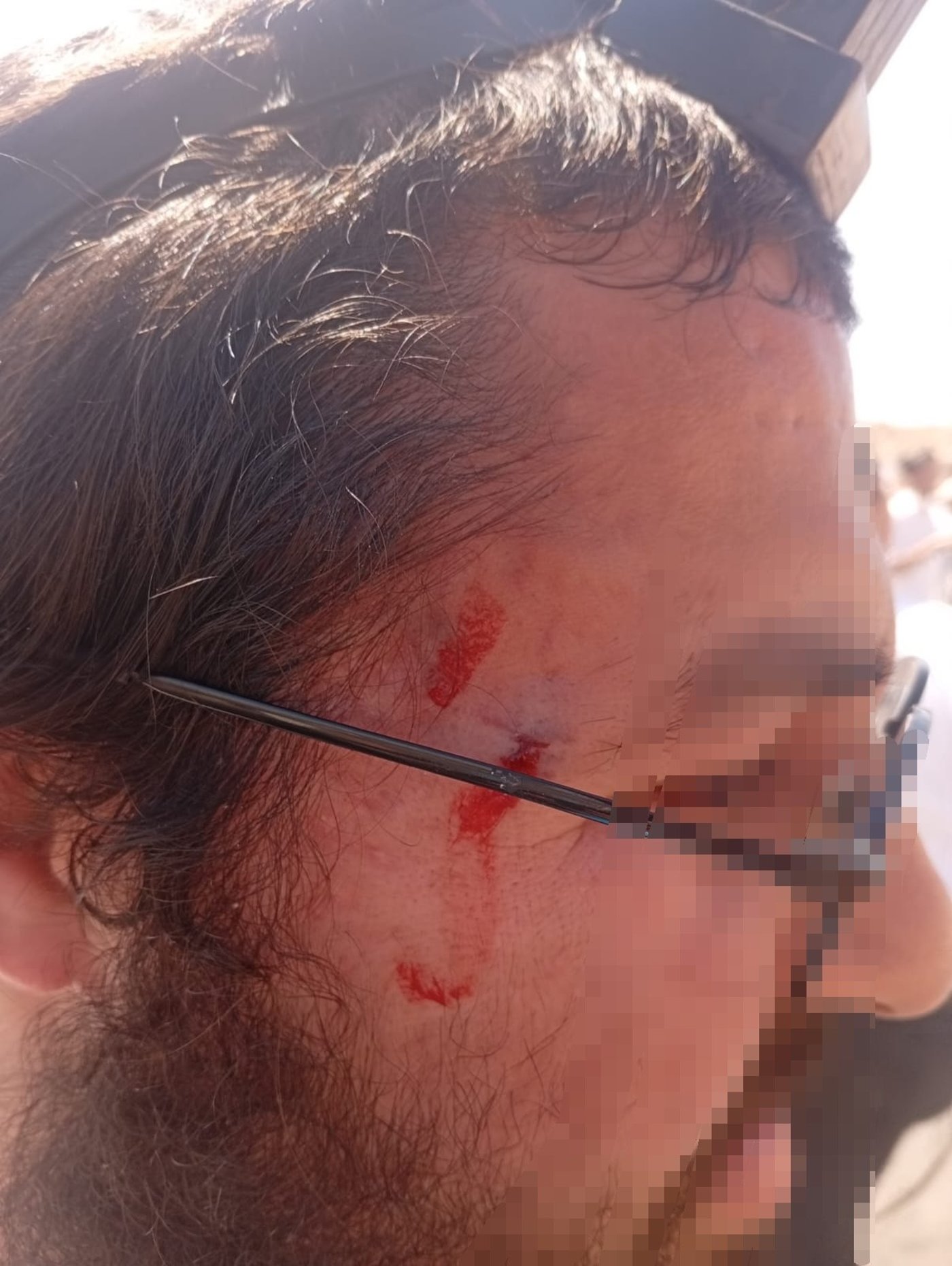 אחייני חבר כנסת חרדי נחקרים במשטרה בעקבות עימותים במיצד