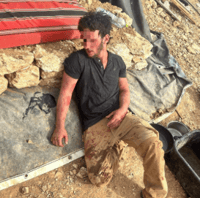 רועה צאן הותקף