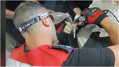 אצבעות הילד חולצו בשלום לאחר שנלכדו במקצף מיקסר ביתי