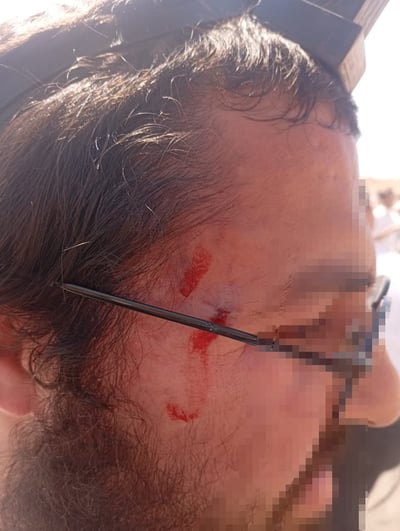אחייני חבר כנסת חרדי נחקרים במשטרה בעקבות עימותים במיצד